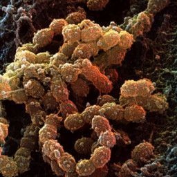 Bacterial World - Microbes That Rule Our World